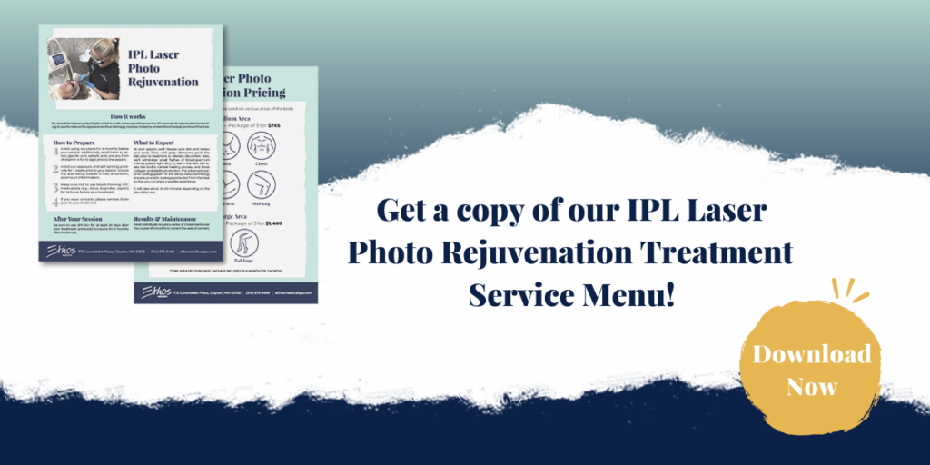 Click here to download the IPL laser photo rejuvenation service menu.