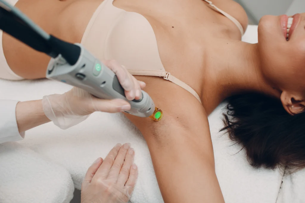 A close-up of a professional performing laser hair removal on a woman's underarm during a treatment session.